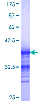 HOXD1 Protein - 12.5% SDS-PAGE Stained with Coomassie Blue.