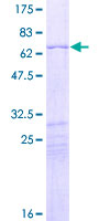 HOXD10 Protein - 12.5% SDS-PAGE of human HOXD10 stained with Coomassie Blue