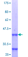 HOXD10 Protein - 12.5% SDS-PAGE Stained with Coomassie Blue.