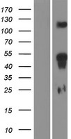 HOXD11 Protein - Western validation with an anti-DDK antibody * L: Control HEK293 lysate R: Over-expression lysate