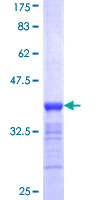 HOXD11 Protein - 12.5% SDS-PAGE Stained with Coomassie Blue