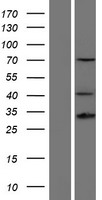 HOXD13 Protein - Western validation with an anti-DDK antibody * L: Control HEK293 lysate R: Over-expression lysate