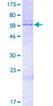 HOXD13 Protein - 12.5% SDS-PAGE of human HOXD13 stained with Coomassie Blue
