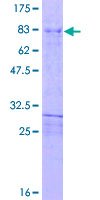 HOXD3 Protein - 12.5% SDS-PAGE of human HOXD3 stained with Coomassie Blue