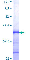 HOXD3 Protein - 12.5% SDS-PAGE Stained with Coomassie Blue.