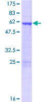 HOXD4 Protein - 12.5% SDS-PAGE of human HOXD4 stained with Coomassie Blue