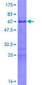 HOXD8 Protein - 12.5% SDS-PAGE of human HOXD8 stained with Coomassie Blue