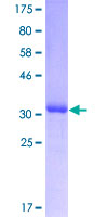 HOXD8 Protein - 12.5% SDS-PAGE Stained with Coomassie Blue.