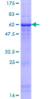 HP / Haptoglobin Protein - 12.5% SDS-PAGE of human HP stained with Coomassie Blue