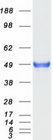 HP / Haptoglobin Protein - Purified recombinant protein HP was analyzed by SDS-PAGE gel and Coomassie Blue Staining