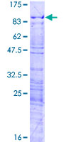 HP1BP3 Protein - 12.5% SDS-PAGE of human HP1BP3 stained with Coomassie Blue