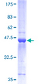 HPCA / Hippocalcin Protein - 12.5% SDS-PAGE of human HPCA stained with Coomassie Blue