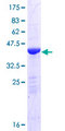 HPCAL1 / Hippocalcin-Like 1 Protein - 12.5% SDS-PAGE of human HPCAL1 stained with Coomassie Blue