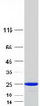 HPCAL1 / Hippocalcin-Like 1 Protein - Purified recombinant protein HPCAL1 was analyzed by SDS-PAGE gel and Coomassie Blue Staining