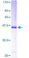 HPCAL4 Protein - 12.5% SDS-PAGE of human HPCAL4 stained with Coomassie Blue