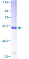 HPCAL4 Protein - 12.5% SDS-PAGE of human HPCAL4 stained with Coomassie Blue