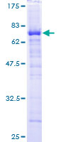 HPD Protein - 12.5% SDS-PAGE of human HPD stained with Coomassie Blue