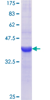 HPD Protein - 12.5% SDS-PAGE Stained with Coomassie Blue