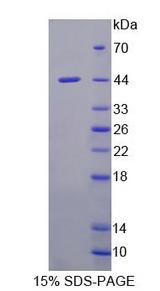 HPD Protein - Recombinant  4-Hydroxyphenylpyruvate Dioxygenase By SDS-PAGE
