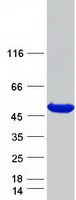 HPD Protein - Purified recombinant protein HPD was analyzed by SDS-PAGE gel and Coomassie Blue Staining