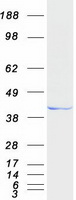 HPDL Protein - Purified recombinant protein HPDL was analyzed by SDS-PAGE gel and Coomassie Blue Staining
