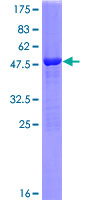 HPGDS Protein - 12.5% SDS-PAGE of human PGDS stained with Coomassie Blue