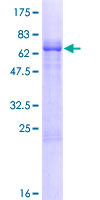 HPH2 / PHC2 Protein - 12.5% SDS-PAGE of human PHC2 stained with Coomassie Blue