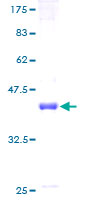 HPMS1 / PMS1 Protein - 12.5% SDS-PAGE of human PMS1 stained with Coomassie Blue