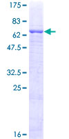 HPN / TMPRSS1 / Hepsin Protein - 12.5% SDS-PAGE of human HPN stained with Coomassie Blue