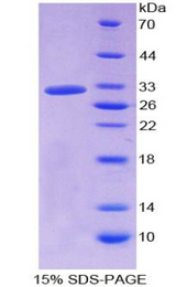 HPR Protein - Recombinant Haptoglobin Related Protein By SDS-PAGE