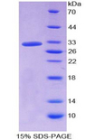 HPR Protein - Recombinant Haptoglobin Related Protein By SDS-PAGE