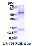 HPR Protein