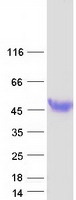 HPR Protein - Purified recombinant protein HPR was analyzed by SDS-PAGE gel and Coomassie Blue Staining