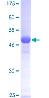 HPRT1 / HPRT Protein - 12.5% SDS-PAGE of human HPRT1 stained with Coomassie Blue