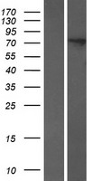 HPS / HPS1 Protein - Western validation with an anti-DDK antibody * L: Control HEK293 lysate R: Over-expression lysate