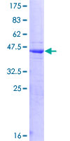 HPS / HPS1 Protein - 12.5% SDS-PAGE of human HPS1 stained with Coomassie Blue