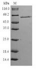 HPS / HPS1 Protein - (Tris-Glycine gel) Discontinuous SDS-PAGE (reduced) with 5% enrichment gel and 15% separation gel.