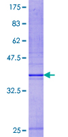 HPS / HPS1 Protein - 12.5% SDS-PAGE Stained with Coomassie Blue.