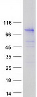 HPS / HPS1 Protein - Purified recombinant protein HPS1 was analyzed by SDS-PAGE gel and Coomassie Blue Staining