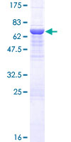 HPS3 Protein - 12.5% SDS-PAGE of human HPS3 stained with Coomassie Blue