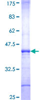 HPS3 Protein - 12.5% SDS-PAGE Stained with Coomassie Blue.
