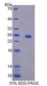 HPS4 Protein - Recombinant  Hermansky Pudlak Syndrome Protein 4 By SDS-PAGE