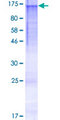HPS5 Protein - 12.5% SDS-PAGE of human HPS5 stained with Coomassie Blue