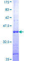 HPS6 Protein - 12.5% SDS-PAGE Stained with Coomassie Blue.