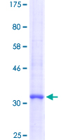 HPSE / Heparanase Protein - 12.5% SDS-PAGE Stained with Coomassie Blue.