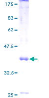 HPT / MRS2L Protein - 12.5% SDS-PAGE of human MRS2L stained with Coomassie Blue
