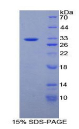 HPTPB / PTPRB Protein - Recombinant Protein Tyrosine Phosphatase Receptor Type B By SDS-PAGE