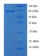 HPV16 L2 Protein