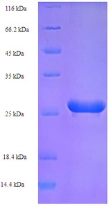 HPV52 E7 Protein