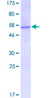 HPX / Hemopexin Protein - 12.5% SDS-PAGE of human HPX stained with Coomassie Blue